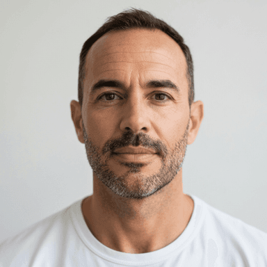 Facial reconstruction case - Before